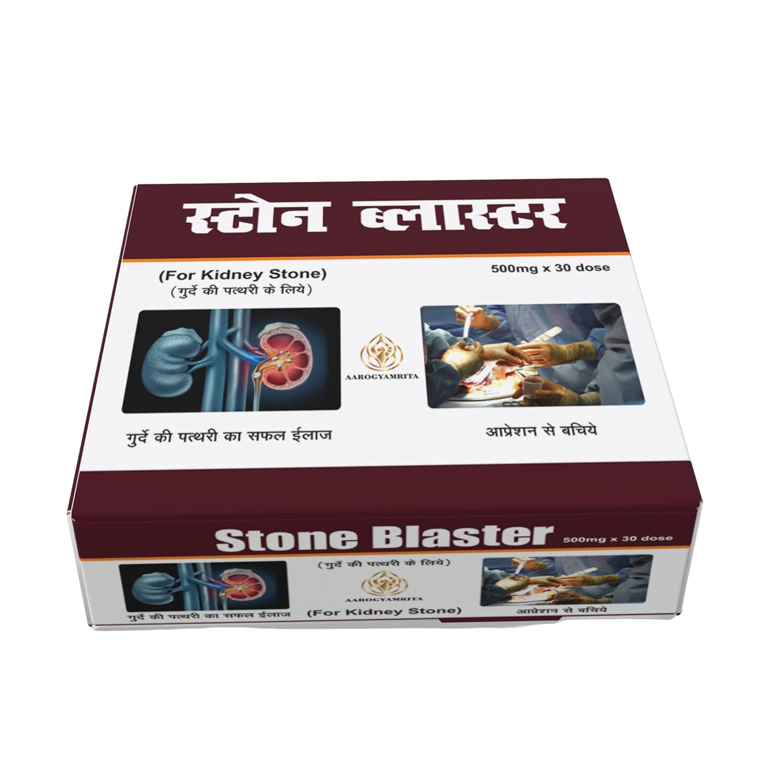 Ayurveda Stone Blaster for Kidney Stone Removal | Ayurvedic Medicine for Gallbladder & Urinary Tract Stones | Natural Herbal Formula to Dissolve Stones & Relieve Pain | 500mg × 30 Doses